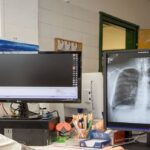 Interjú a dunakeszi szakorvosi rendelőintézet orvos-igazgatójával az AI-alapú radiológiai diagnosztika bevezetéséről dkeszitudo